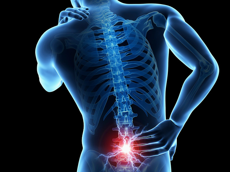 ejercicios para protusion lumbar